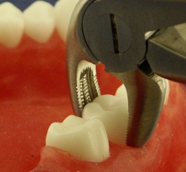 Extraction & Elevation