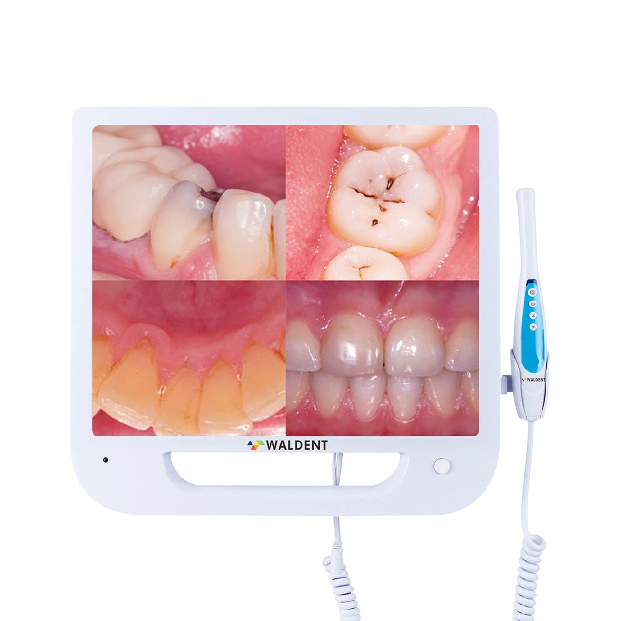 Intraoral Cameras