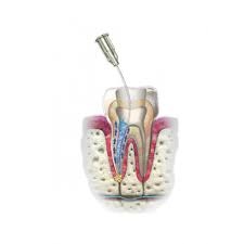 Irrigation & Lubrication