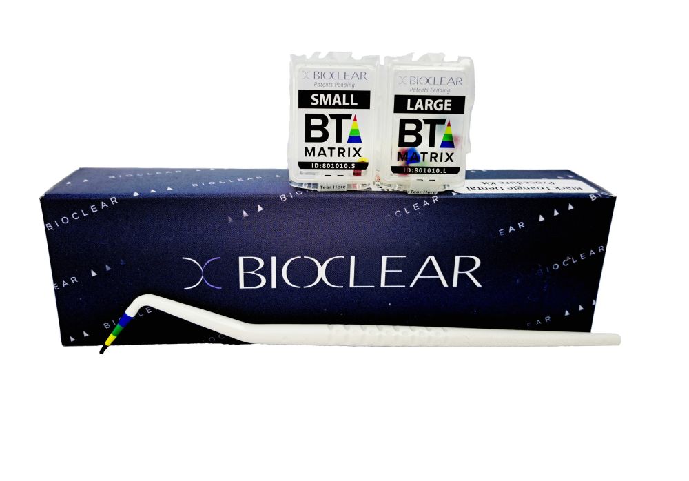 Bioclear Black Triangle Procedure Matrix System Kit