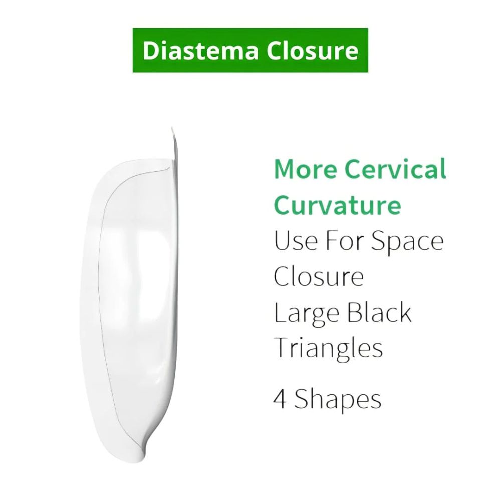 Bioclear Diastema Matrix Closure Series